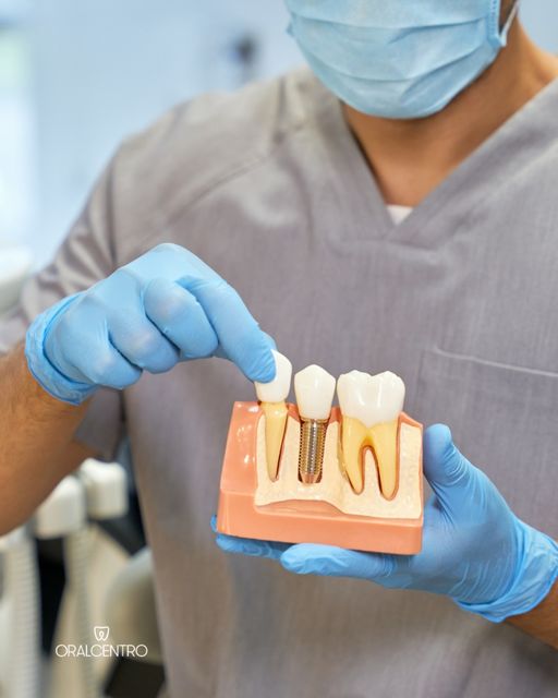 implante dentário porto